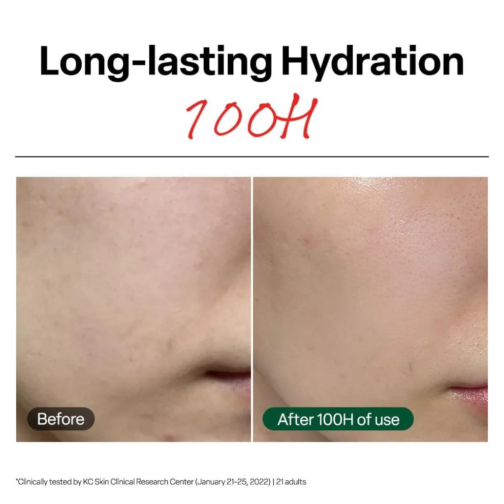Dr.G Red Blemish Clear Soothing Cream 70ml - Comparaison « avant-après » de la peau mettant en évidence la clarté et l'hydratation de la joue d'une personne, avec la mention « Hydratation longue durée 100H » en haut et une petite note de bas de page relative à un test clinique en bas - SKINOREA K-beauty shop France Paris