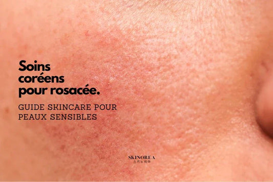 Soins coréens pour la rosacée : guide peaux sensibles
