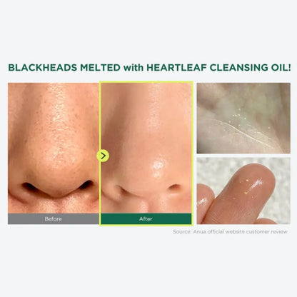 Anua Heartleaf Pore Control Cleansing Oil 200ml - Huile nettoyante vegan non comédogène - Avant Après - Kbeauty Korean skincare Europe fast delivery - Skincare coréenne Skinorea shop Paris France livraison rapide - yesstyle