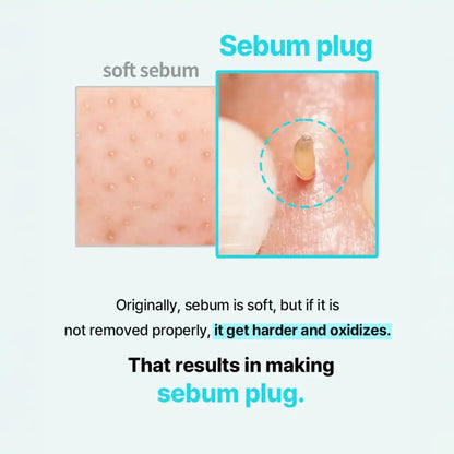 Ilso Super Melting Sebum Softener - Comment ça marche - Soin pour l'excès de sébum et anti-points noirs - texture - K-beauty soin cosmétique corée Skinorea shop France livraison rapide - yesstyle